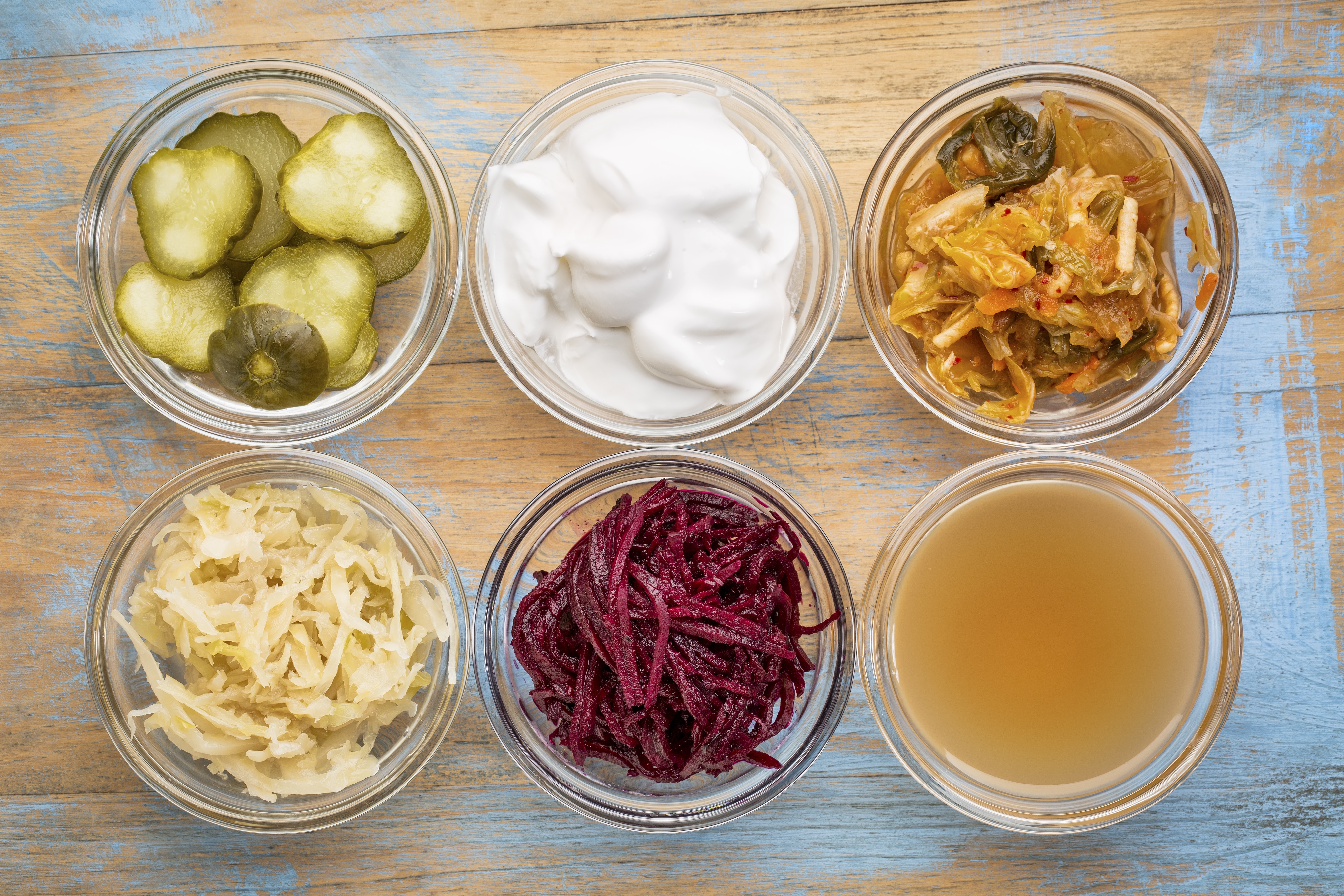 fermented foods for a healthy gut